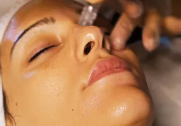 Tratamientos Faciales