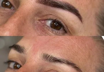 Arquitectura de cejas